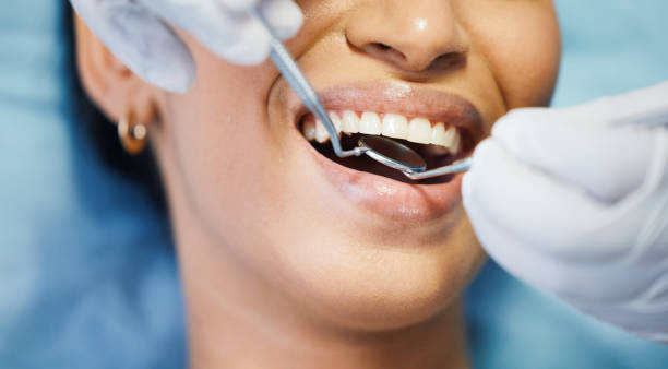 Best Emergency Denture Repair in Pine Grove Mills, PA