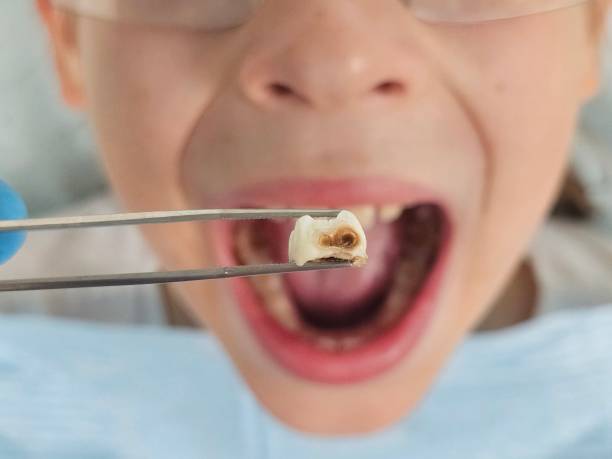 Best Emergency Cosmetic Dentistry (e.g., broken veneers) in Pine Grove Mills, PA