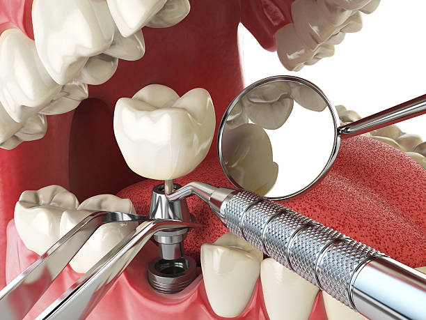Best Emergency Treatment for Jaw Pain or Injury in Pine Grove Mills, PA